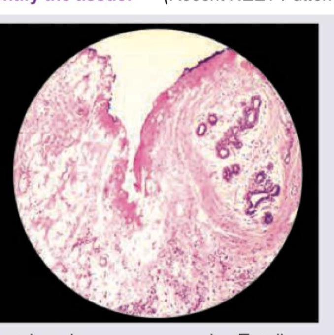 Image for question 1313