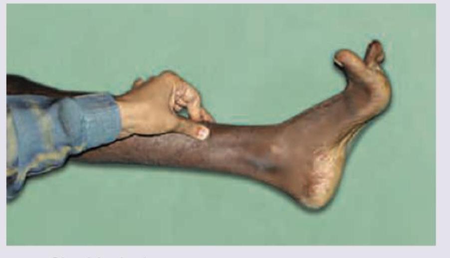 Image for question 287