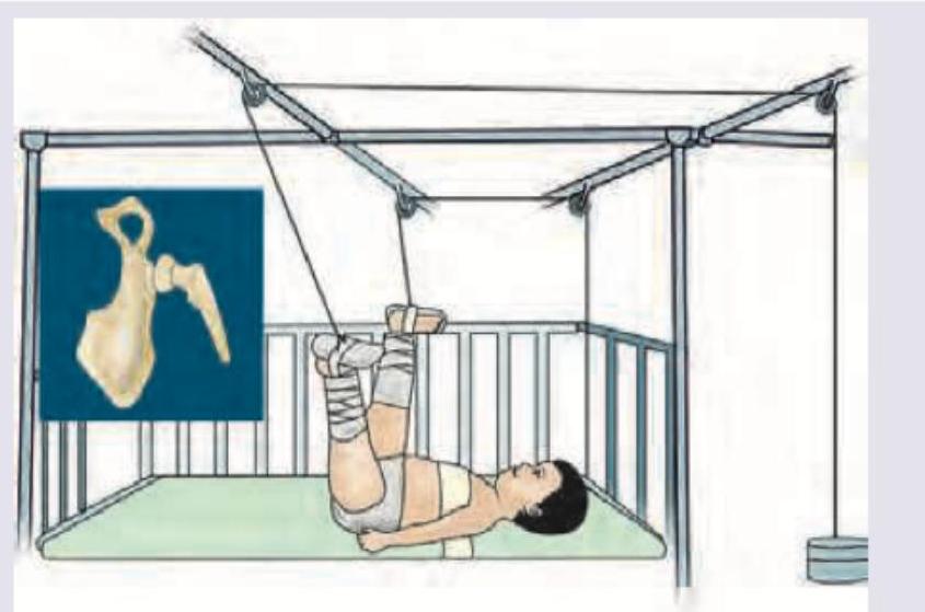 Image for question 902