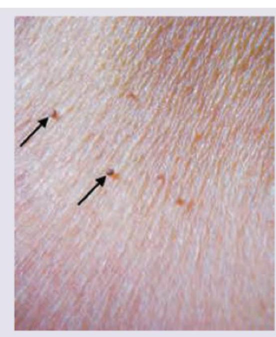 Image for question 211