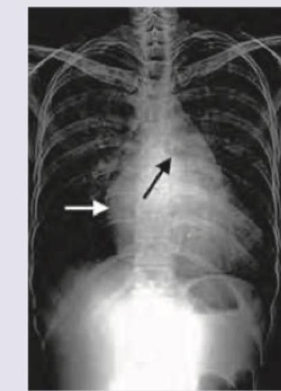 Image for question 379