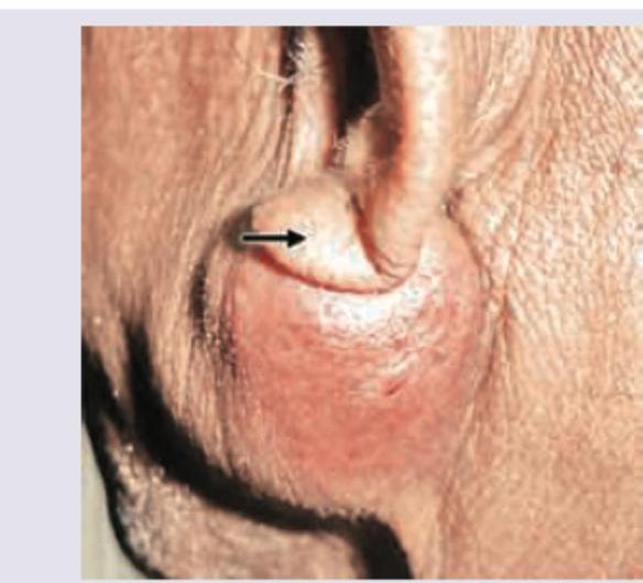 Image for question 311