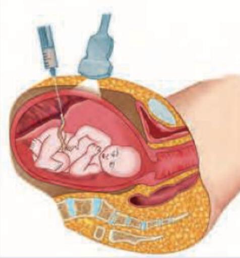 Image for question 6