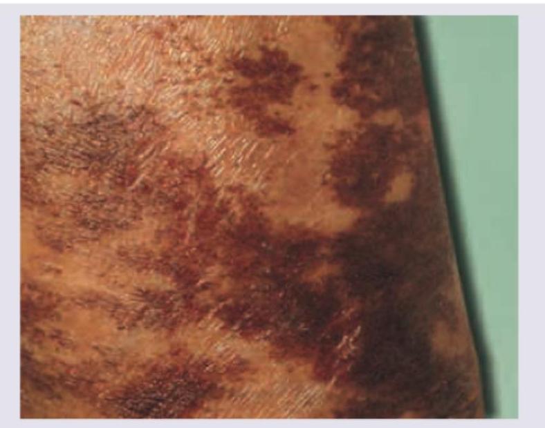 Image for question 90