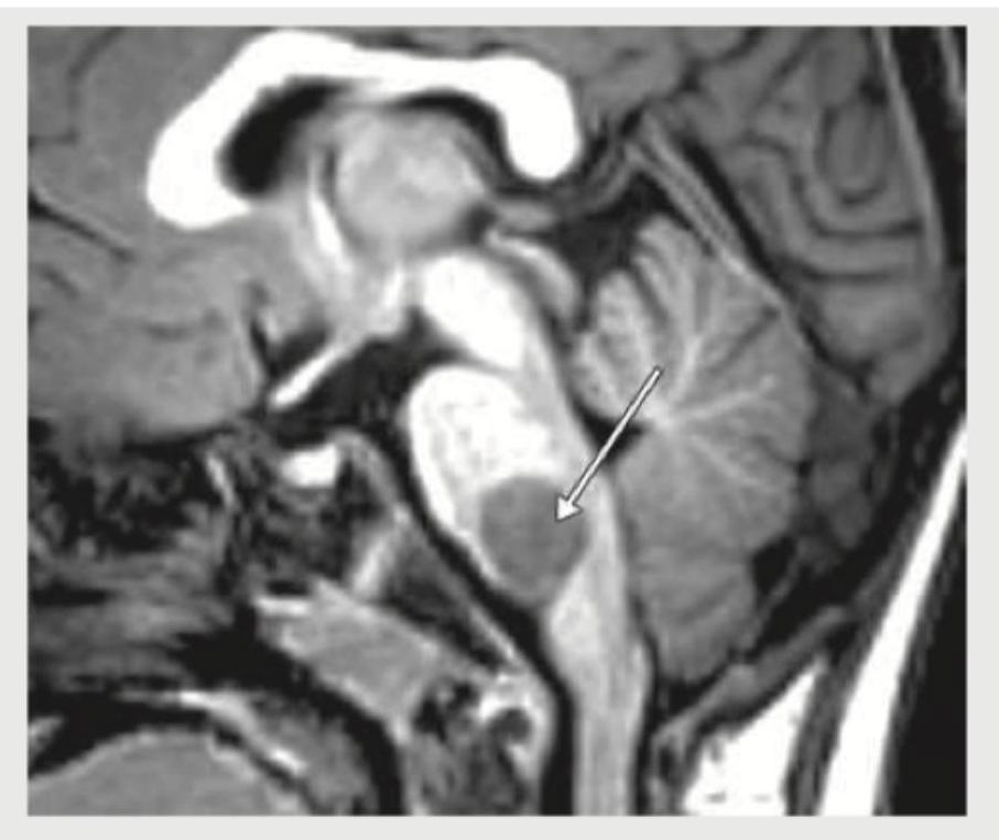 Image for question 354