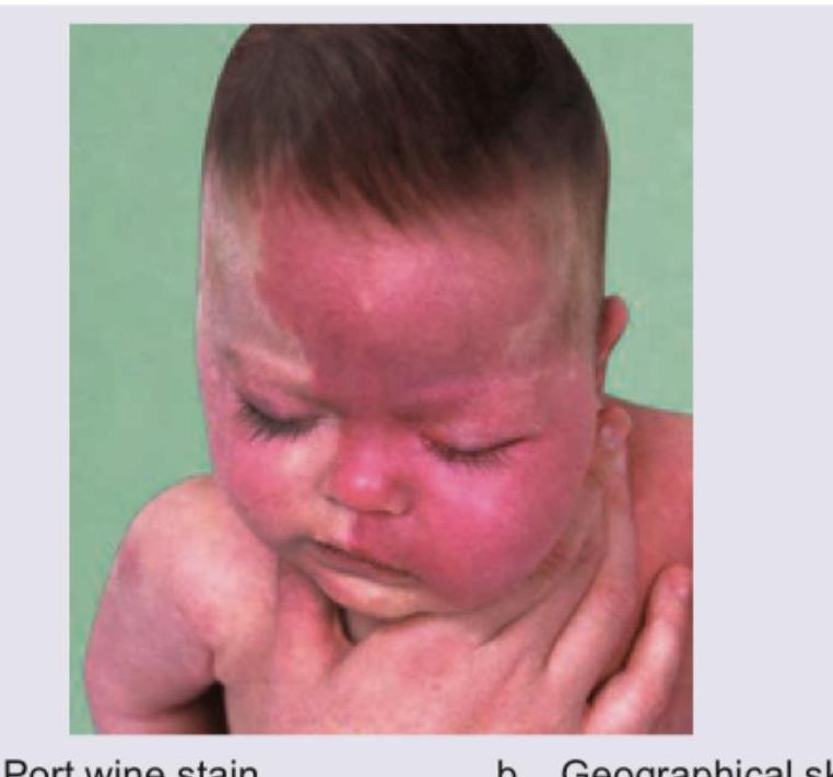 Image for question 648