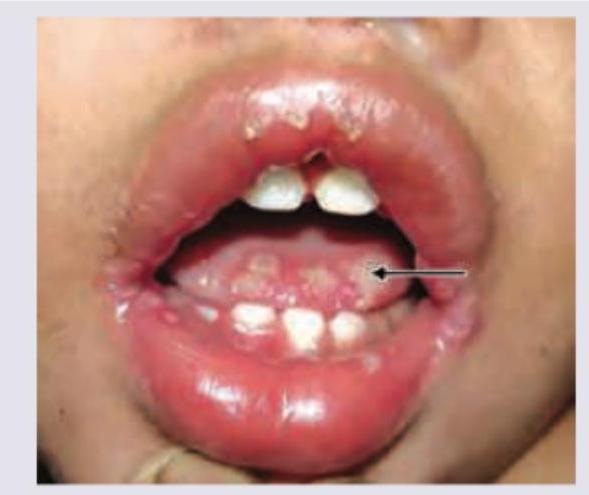 Image for question 1228