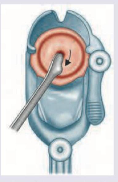 Image for question 916