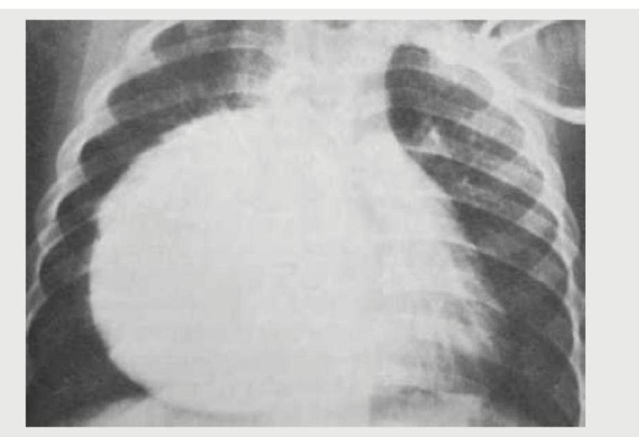 Image for question 105