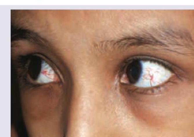 Image for question 231