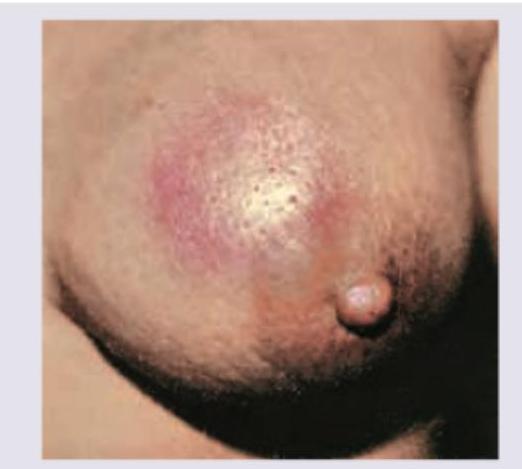 Image for question 699