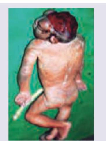 Image for question 725