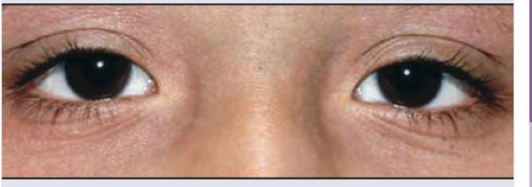 Image for question 730