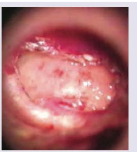 Image for question 209