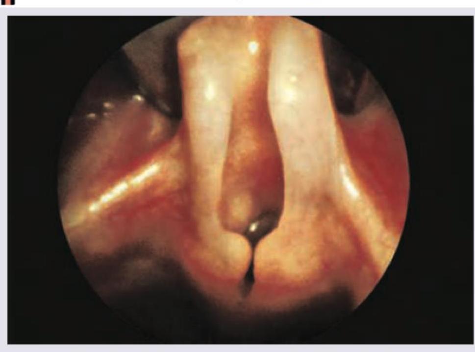 Image for question 198