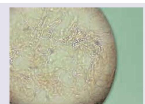 Image for question 114