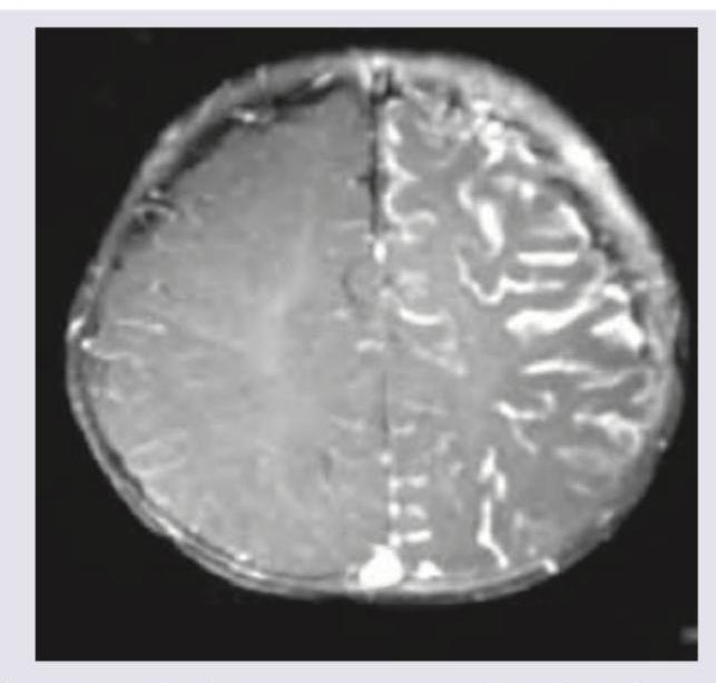 Image for question 339