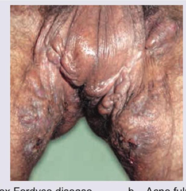 Image for question 83