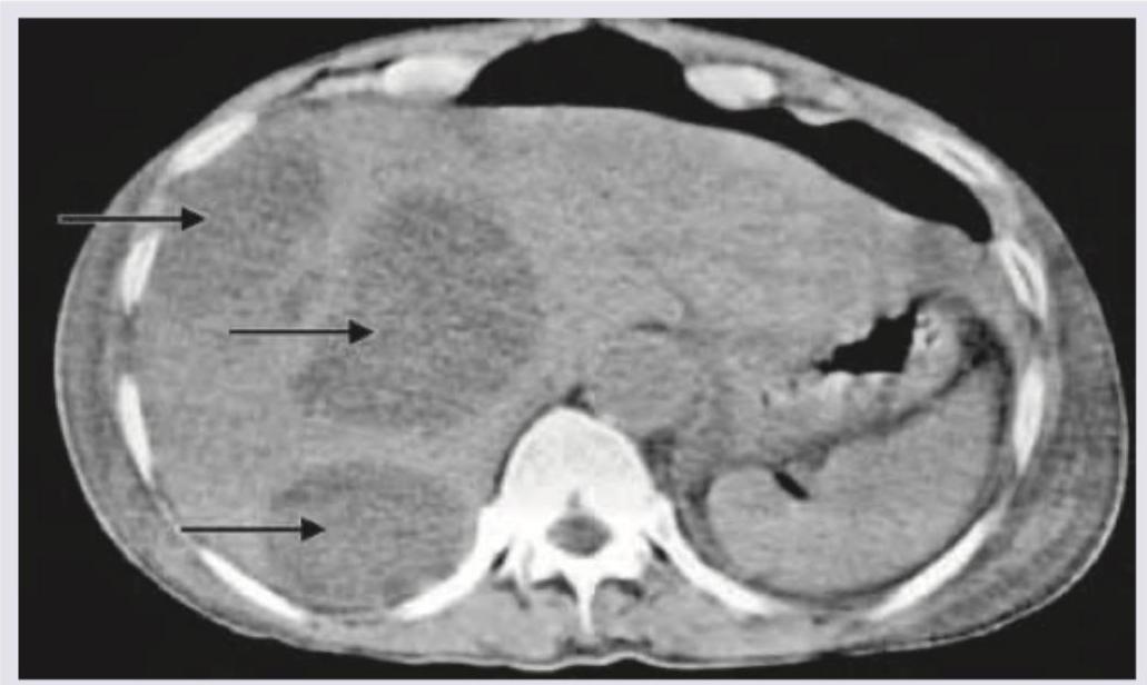 Image for question 538