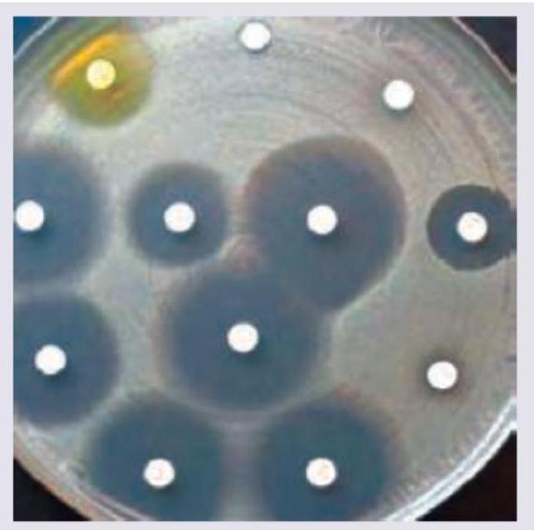 Image for question 51