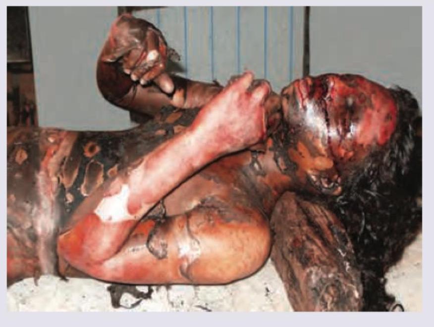 Image for question 233