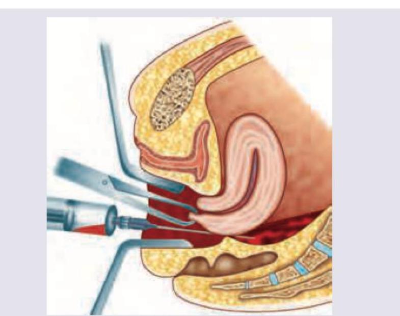 Image for question 911