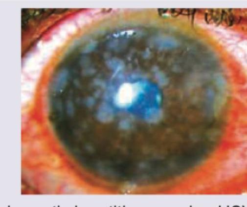 Image for question 330