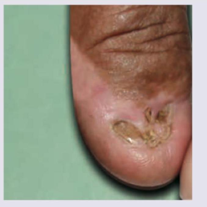 Image for question 60