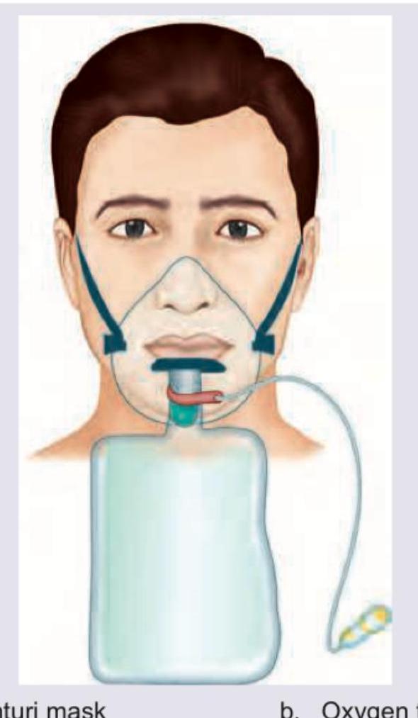 Image for question 288