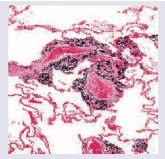 Image for question 414