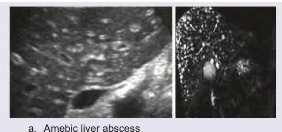 Image for question 739