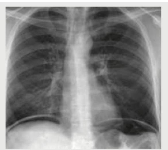 Image for question 2