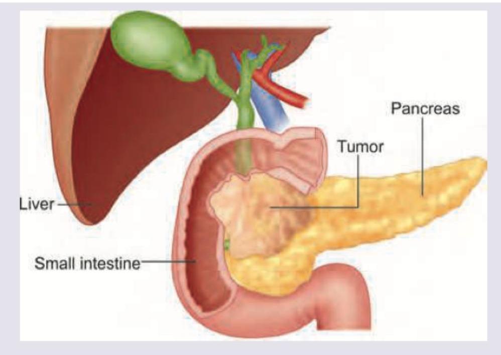 Image for question 293