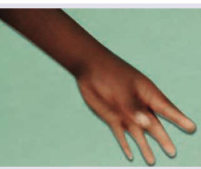 Image for question 635