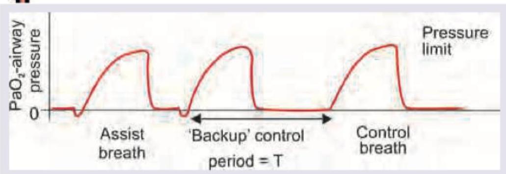 Image for question 306