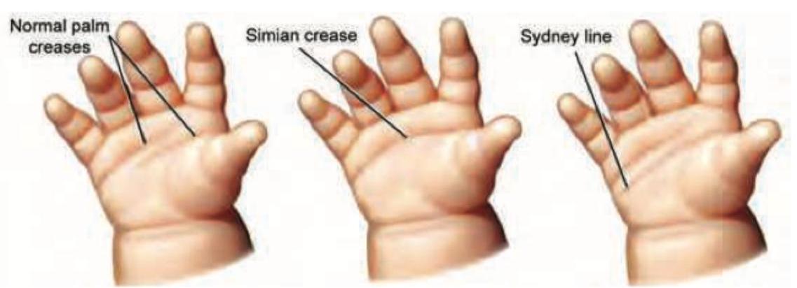 Image for question 627