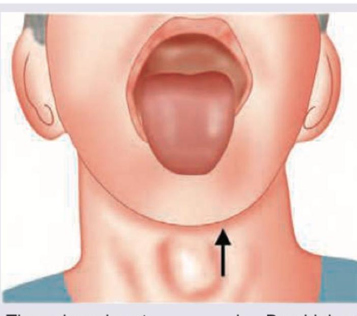 Image for question 310