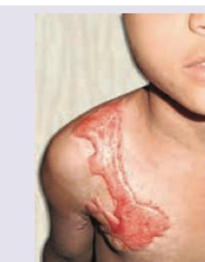 Image for question 203