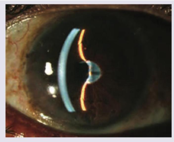 Image for question 250