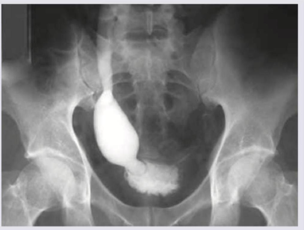 Image for question 937