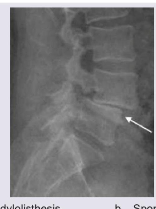 Image for question 146