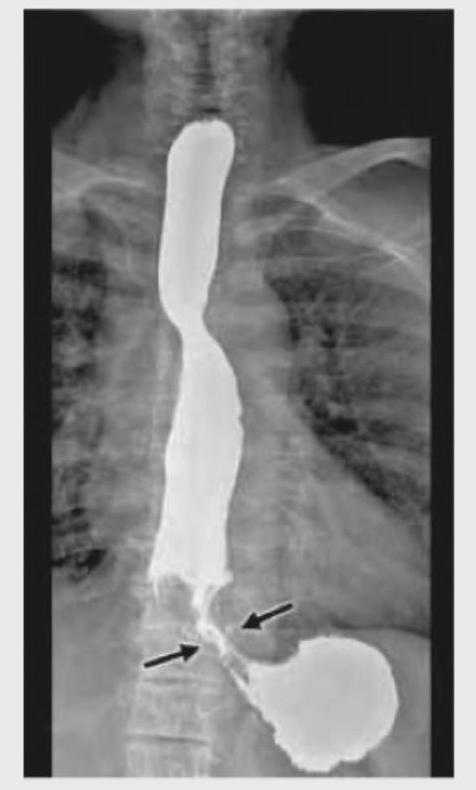 Image for question 175