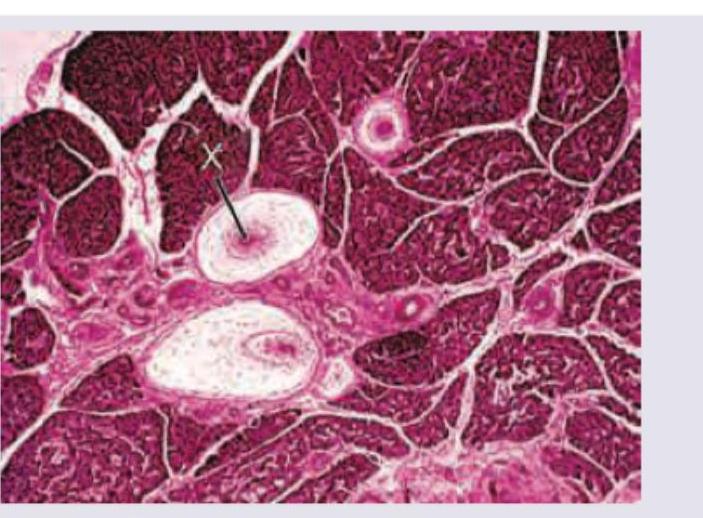 Image for question 392