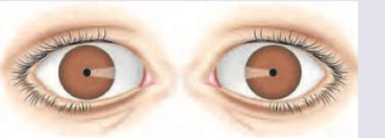 Image for question 30