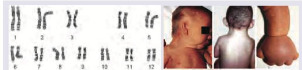 Image for question 1316