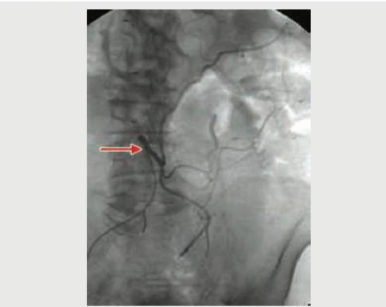 Image for question 108