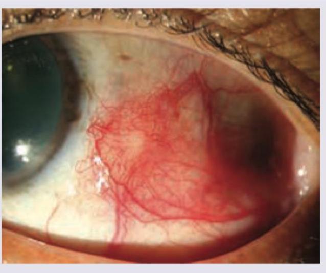 Image for question 258