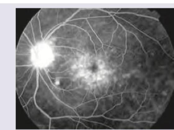 Image for question 446