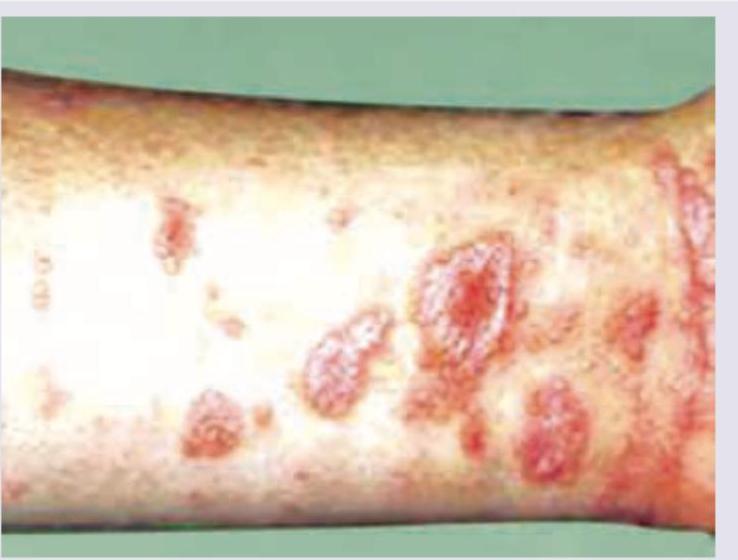 Image for question 246