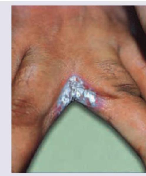 Image for question 118